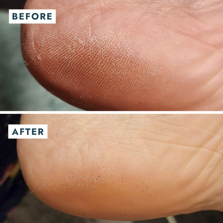 SOLEMATE HEEL REPAIR BALM