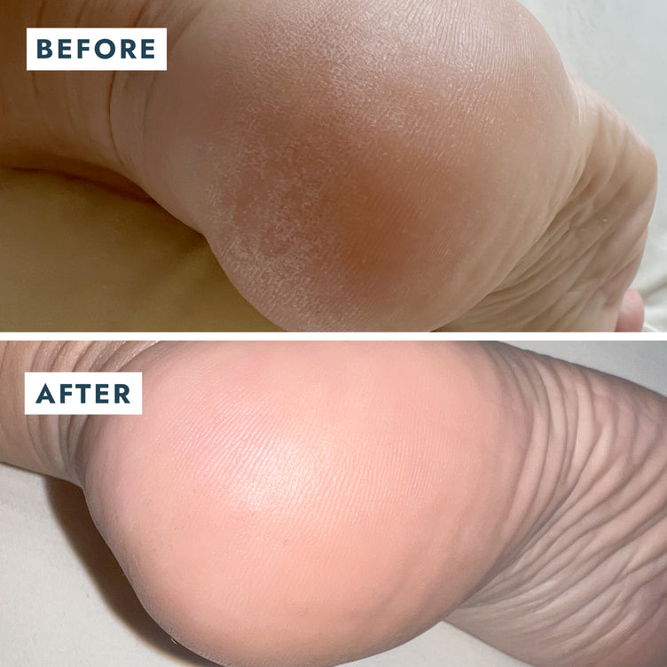 SOLEMATE HEEL REPAIR BALM