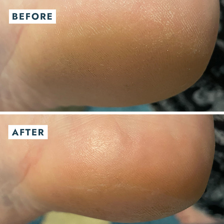 SOLEMATE HEEL REPAIR BALM